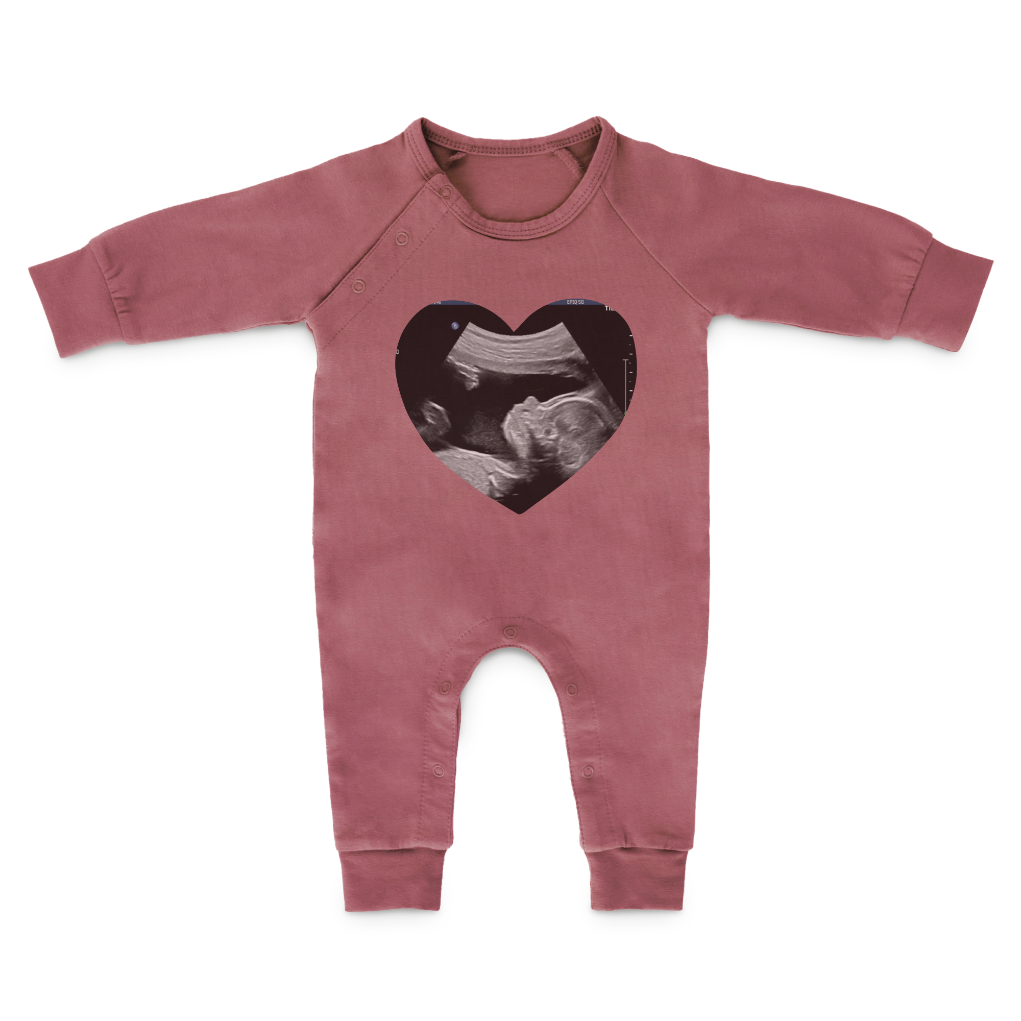 Babyplaysuit med tryk
