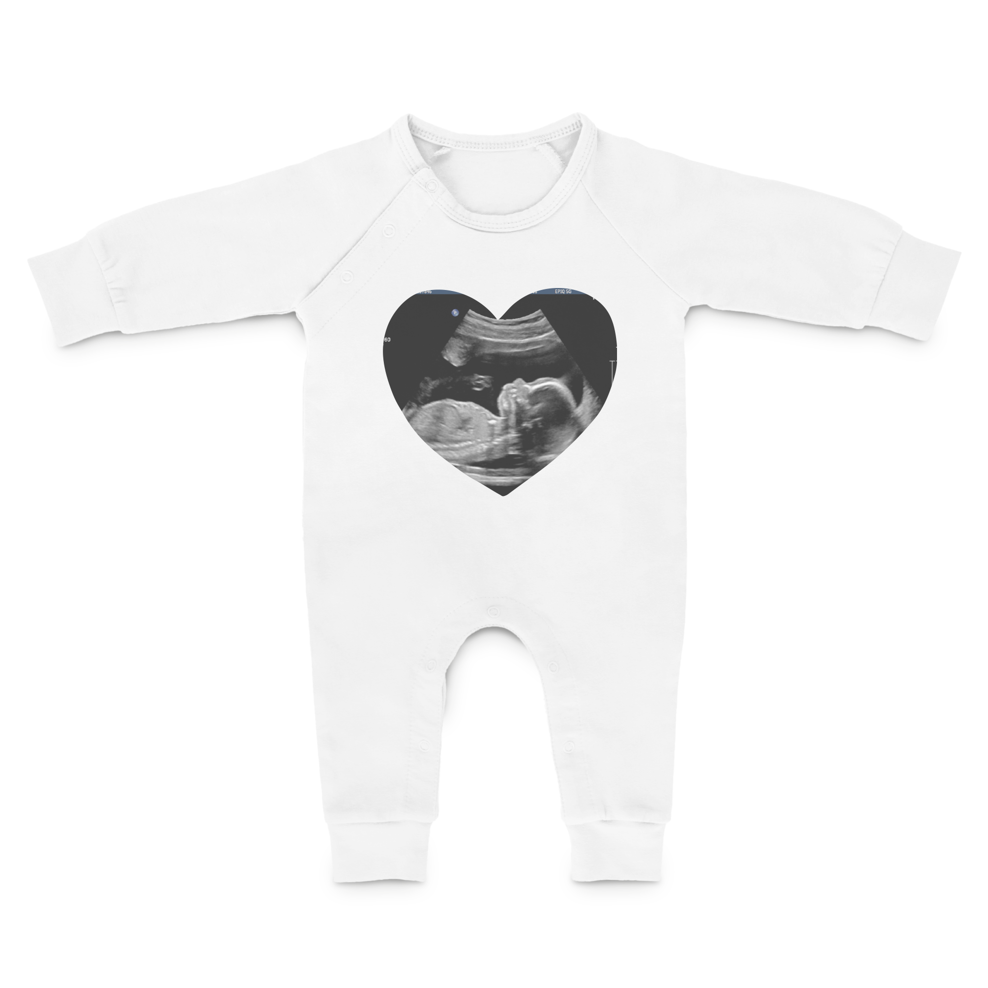 Vit babylekdräkt med personligt tryck av ett ultraljudsfoto format som ett hjärta. Skapa din personliga babylekdräkt.