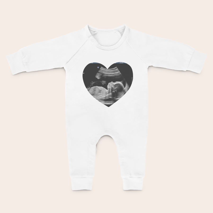 Grenouillère bébé personnalisé Grenouillère bébé personnalisé