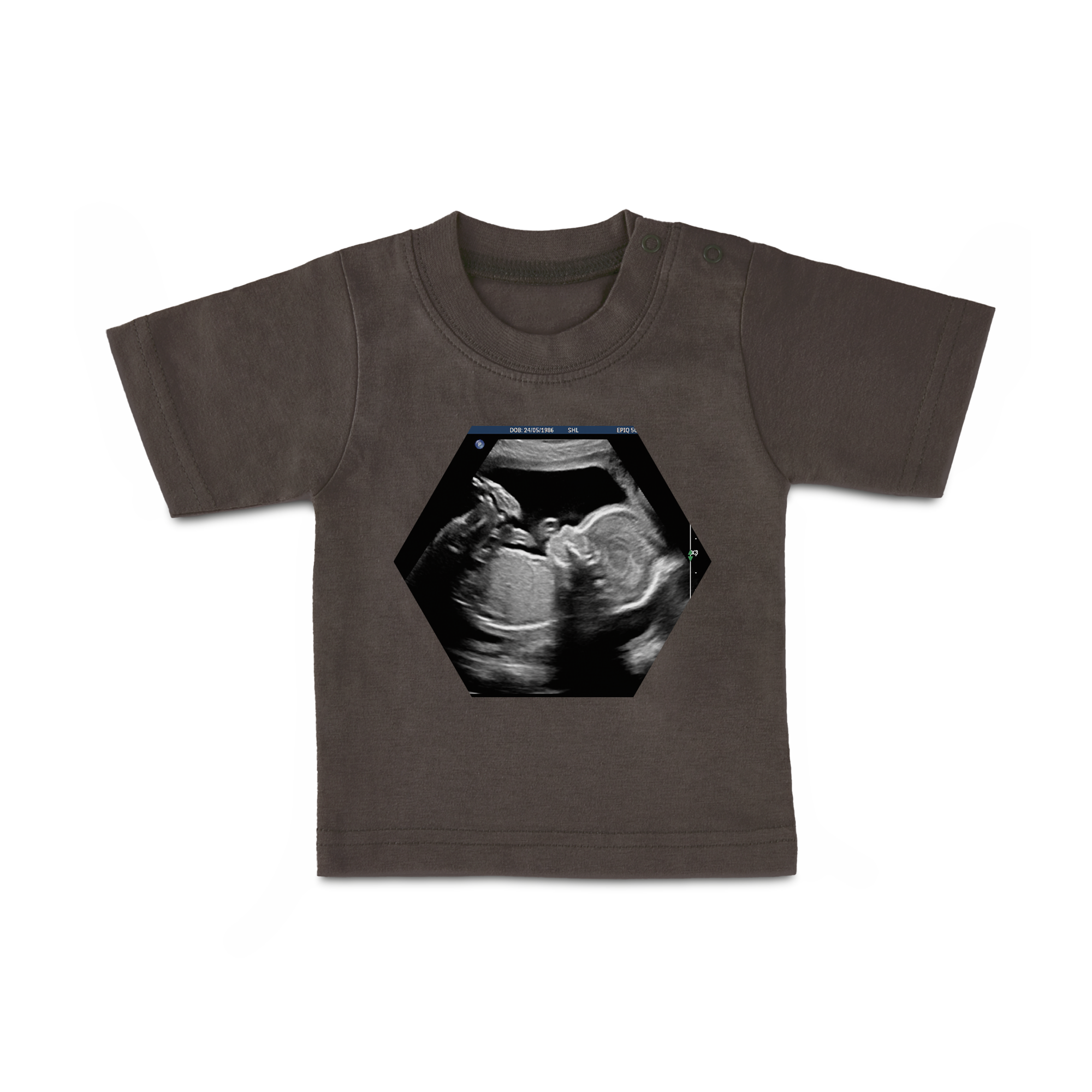 Ciemnoszary personalizowany t-shirt dla maleństwa z dowolnym nadrukiem, np. zdjęciem z USG dziecka