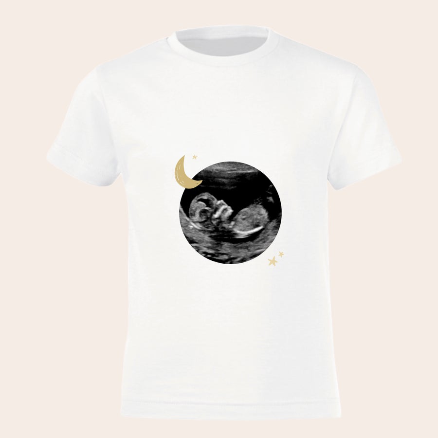 Camiseta personalizada - Hermano / hermana mayor Camiseta blanca personalizada para niños con foto de ecografía circular y luna creciente dorada. ¡Agrega un toque extra especial a su anuncio de embarazo!