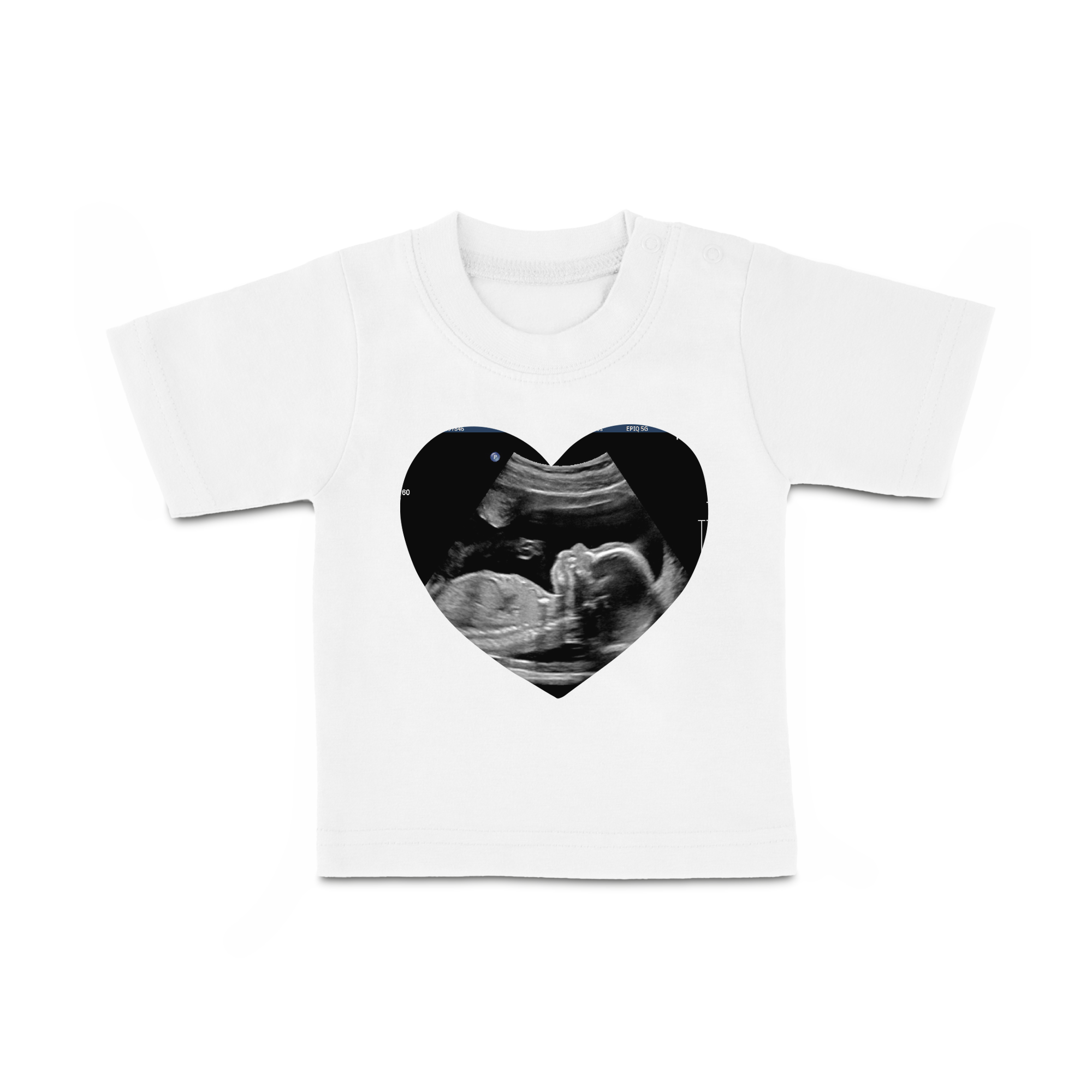 Camiseta de bebé blanca personalizada con ecografía de feto en un corazón negro. Personaliza una camiseta para tu bebé con una foto.