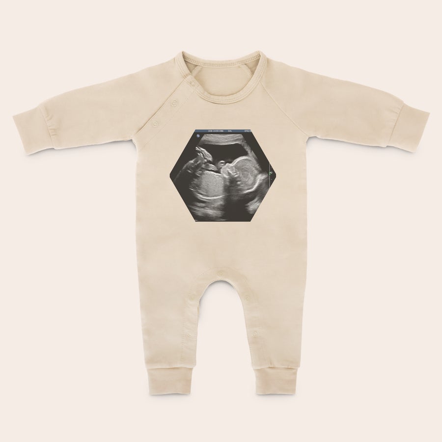 Baby lekedrakt med trykk Personlig sparkedress i beige bomull, trykt med et ultralydbilde. Ideell for å strekke og sparke med lubne ben.