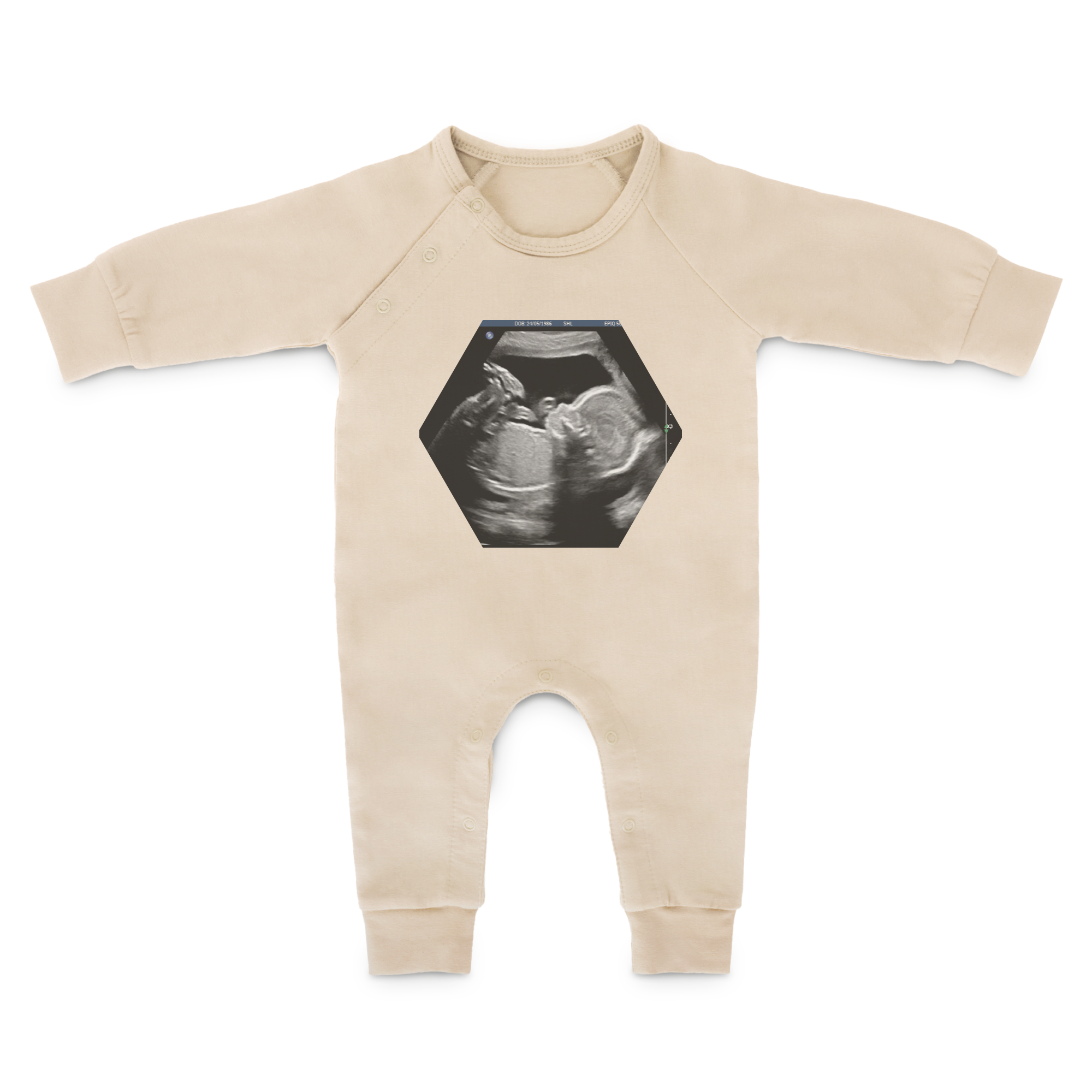 A beige personalised babygrow with long sleeves, printed with a hexagon-shaped ultrasound image of a baby stretching and kicking those chubby legs