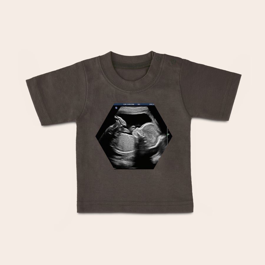 Baby shirt bedrukken Donkergrijs baby shirt bedrukt met een echofoto in zeshoekige vorm, voor een uniek baby shirt met foto.